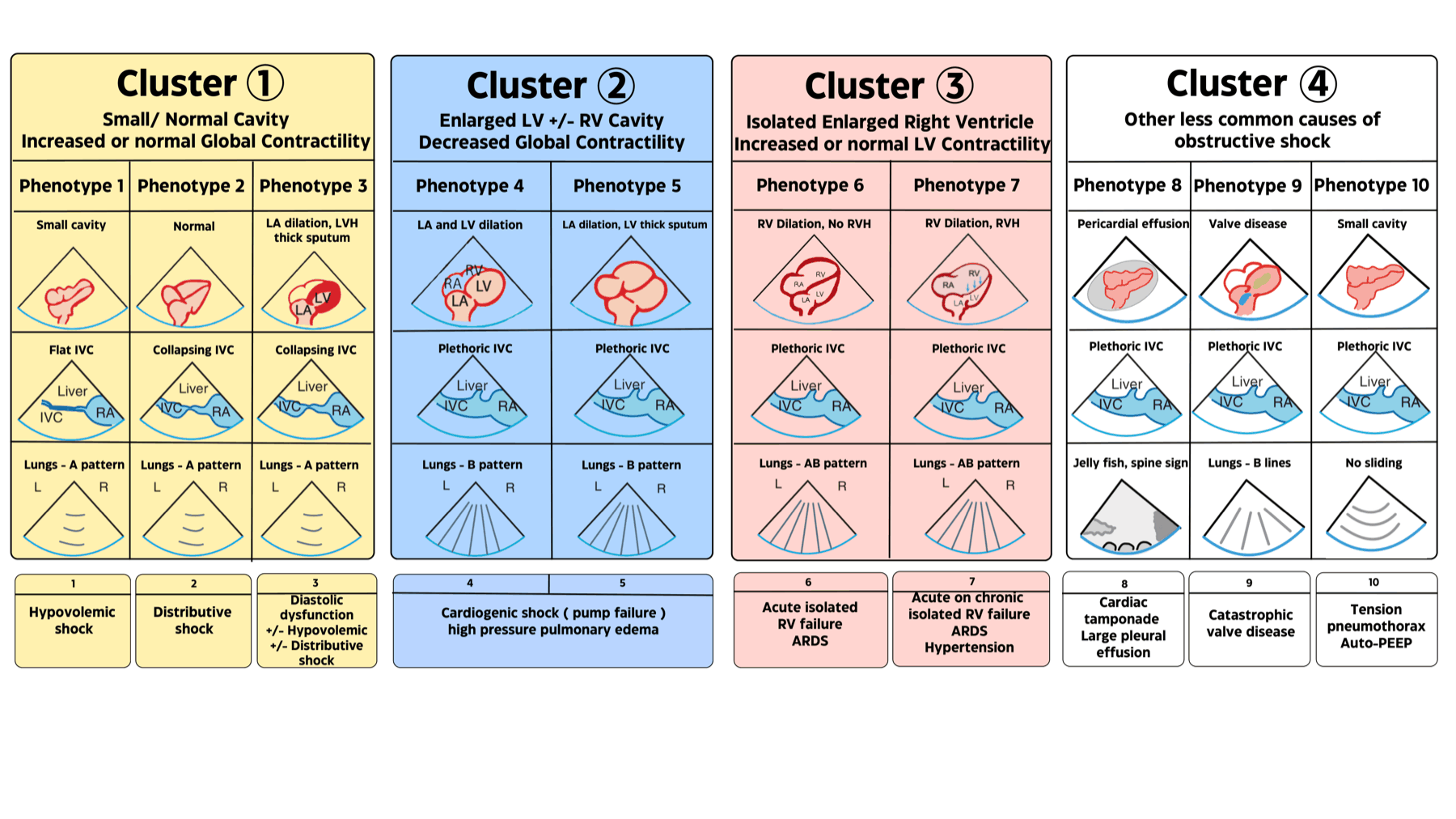 The EASy POCUS phenotype chart: 4 hemodynamic clusters (1 yellow small/normal cavity, 2 blue enlarged LV, 3 red isolated enlarged RV, 4 white obstructive) and 10 hemodynamic phenotypes, each showing the heart, IVC, and lung/pleura pattern with the corresponding shock diagnosis.